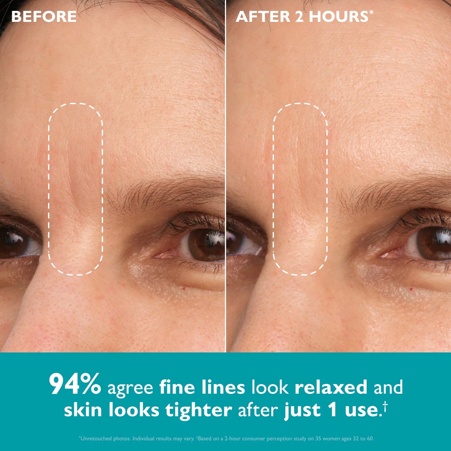 AUROXEN Peptide-Infused Face & Eye Tape