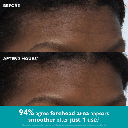 AUROXEN Peptide-Infused Face & Eye Tape