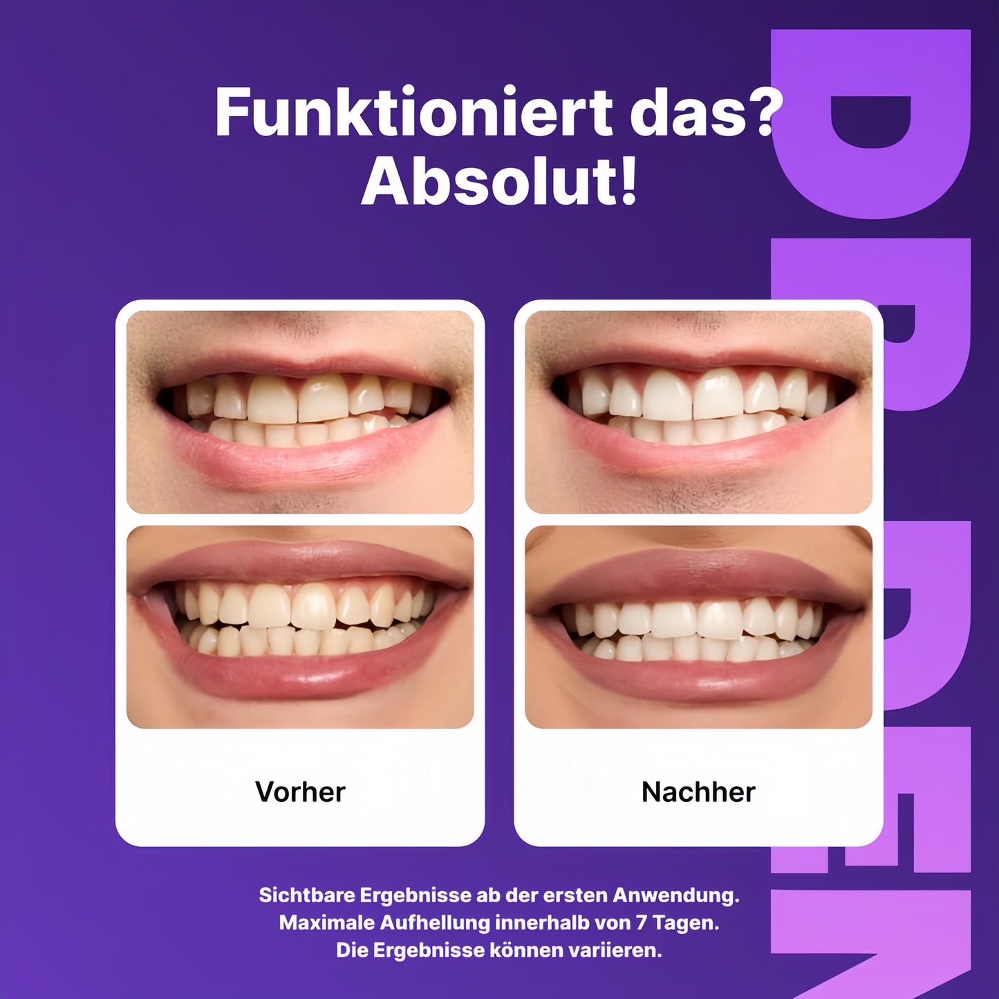 Violette Zahnaufhellungsstreifen