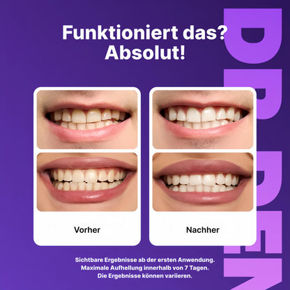 Violette Zahnaufhellungsstreifen