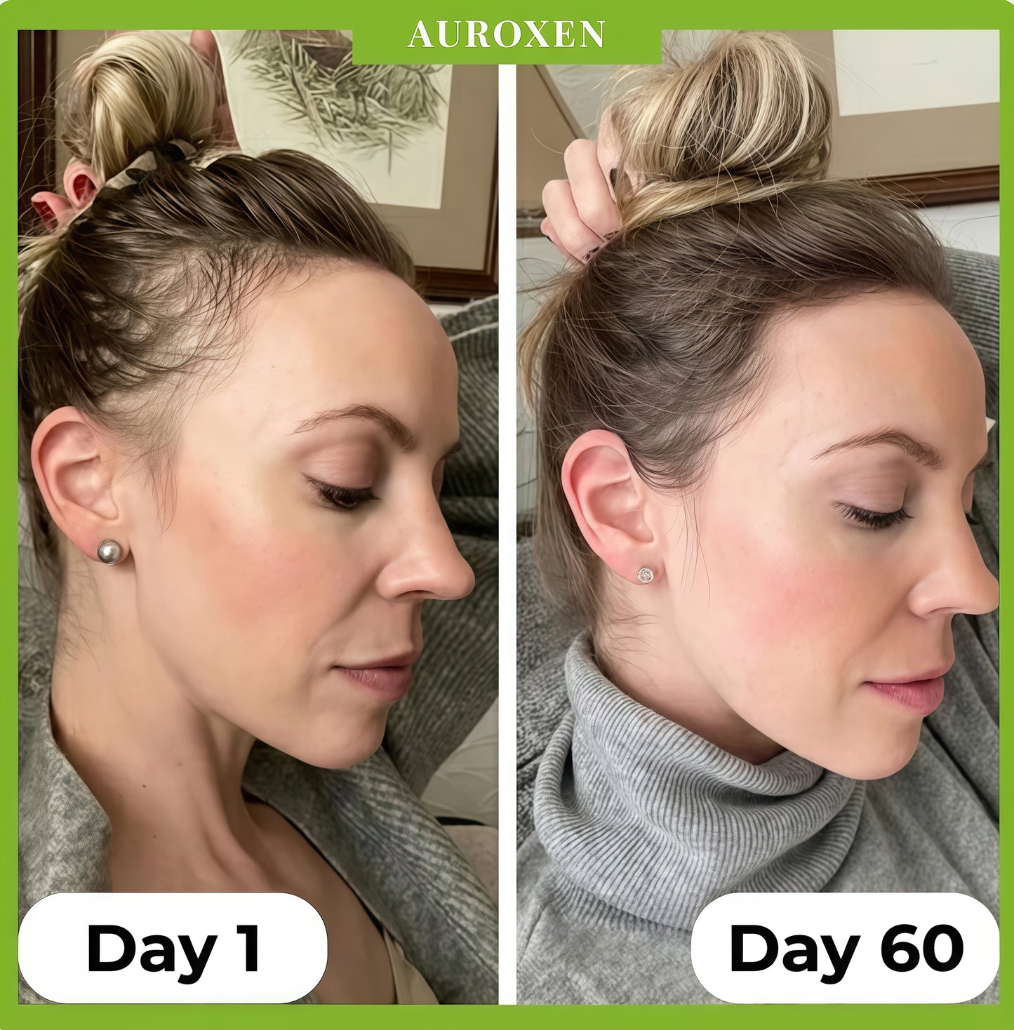 AUROXEN Scalp Renewal Roll-On