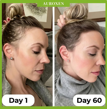 AUROXEN Scalp Renewal Roll-On