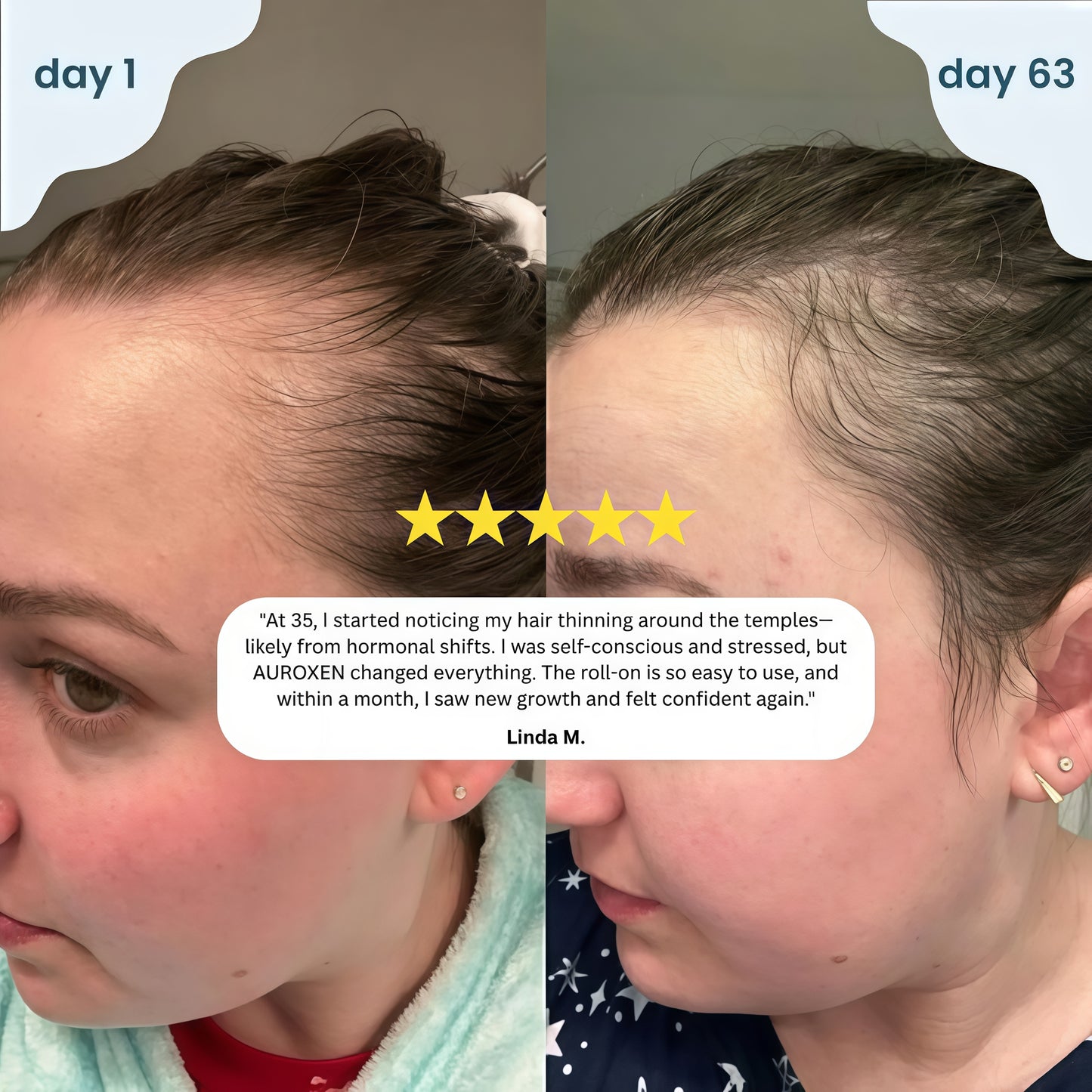 AUROXEN Scalp Renewal Roll-On