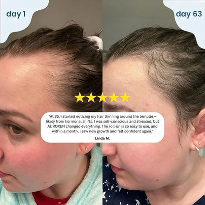 AUROXEN Scalp Renewal Roll-On