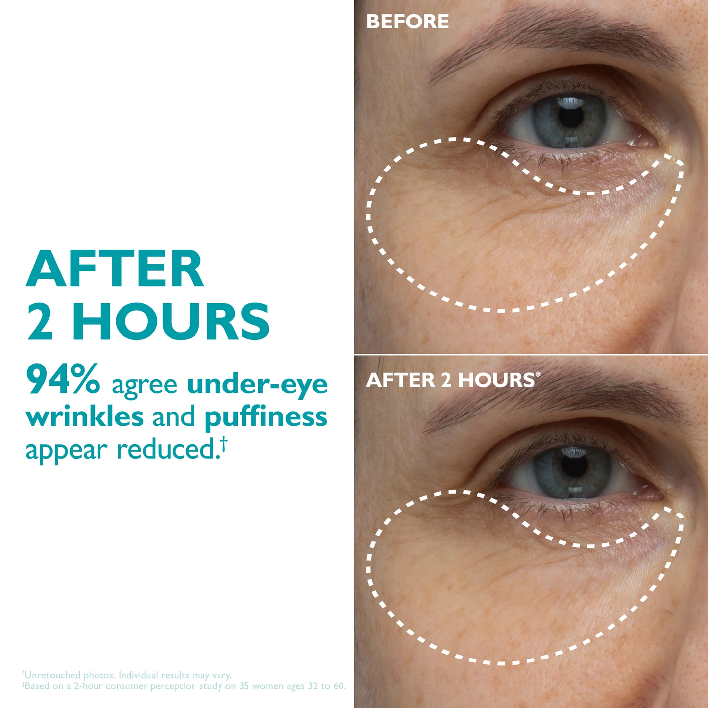 AUROXEN Peptide-Infused Face & Eye Tape