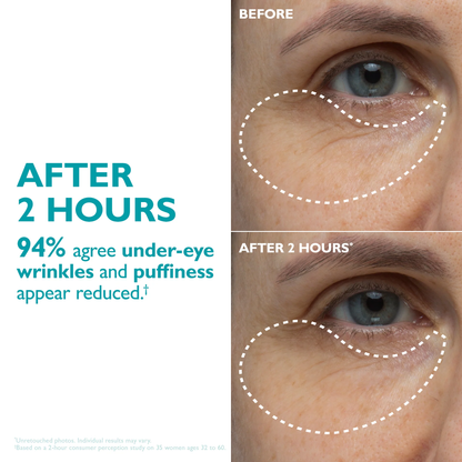 AUROXEN Peptide-Infused Face & Eye Tape