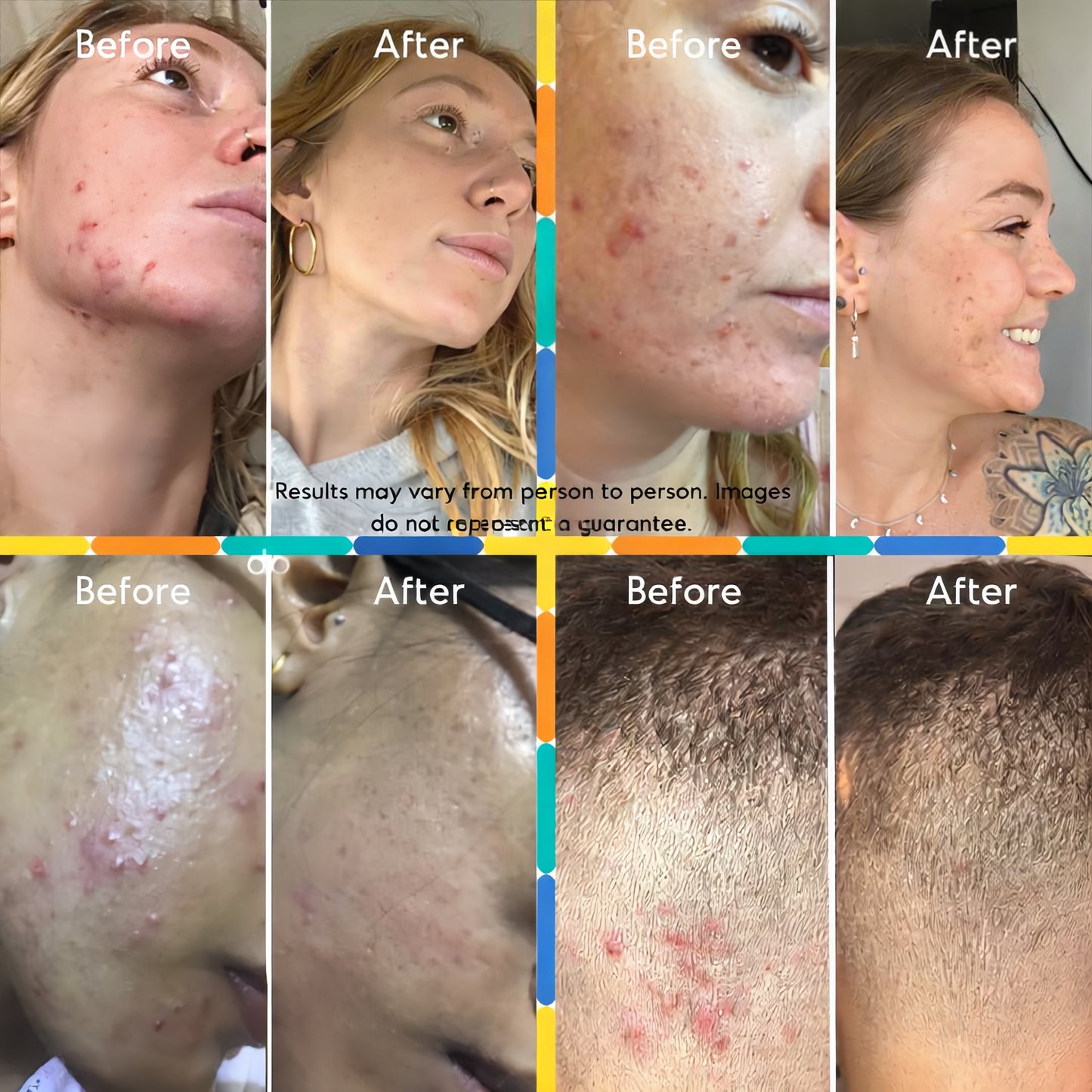 Mandelic Acid Body Serum