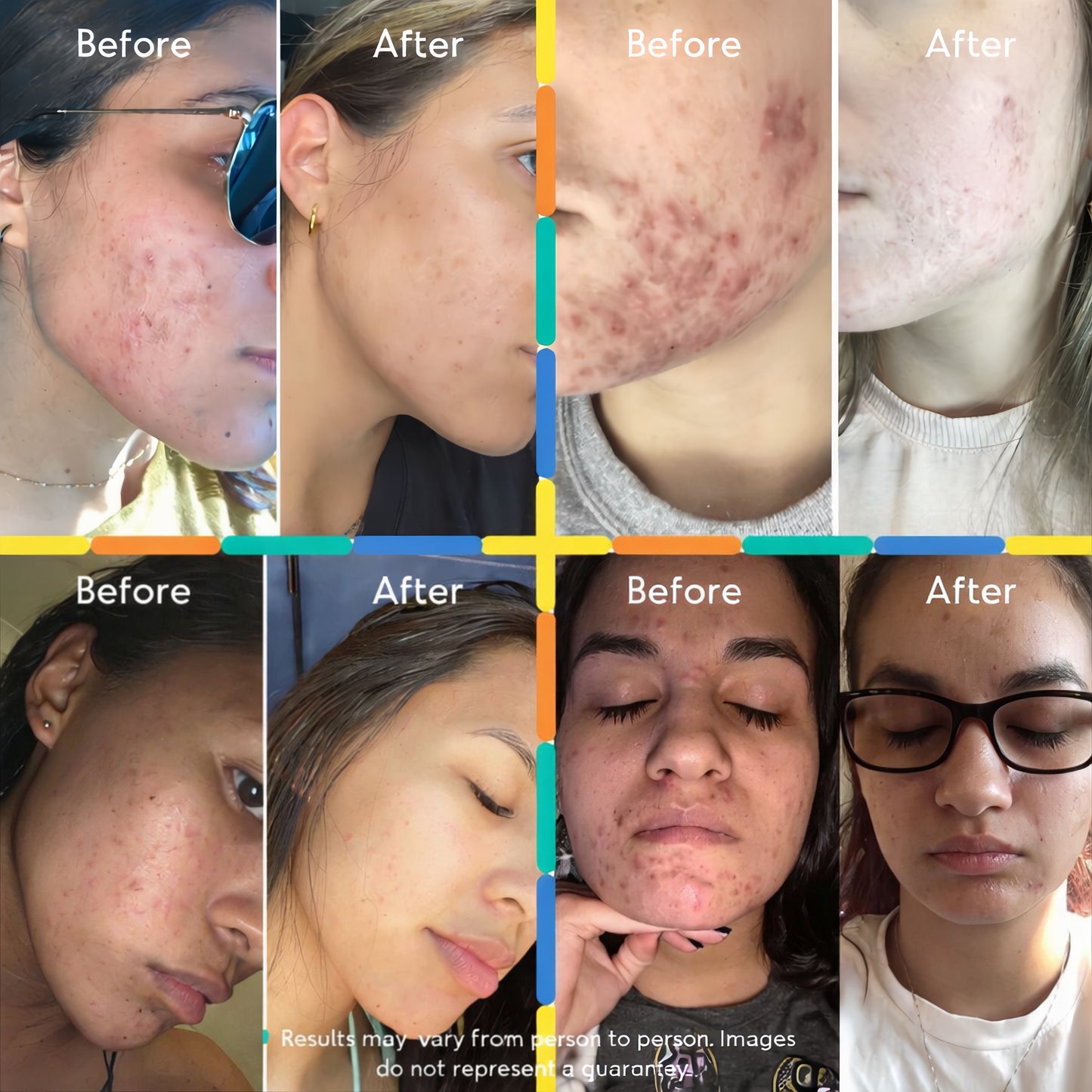 Mandelic Acid Body Serum