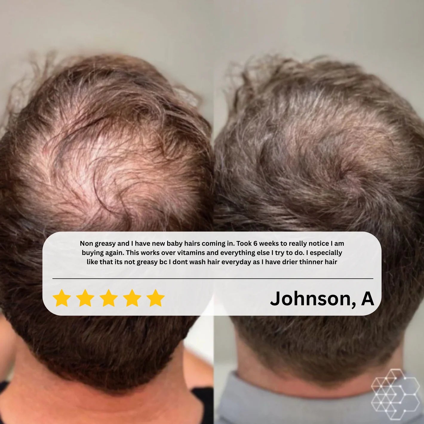 AUROXEN Scalp Renewal Roll-On